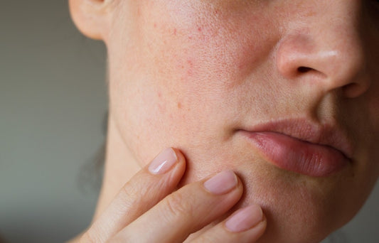 4 Crucial Reasons Why You Shouldn’t Skip Moisturizer