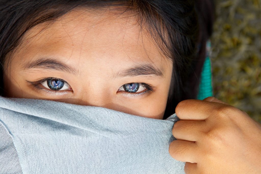 The Cause of Eye Bags and Circles