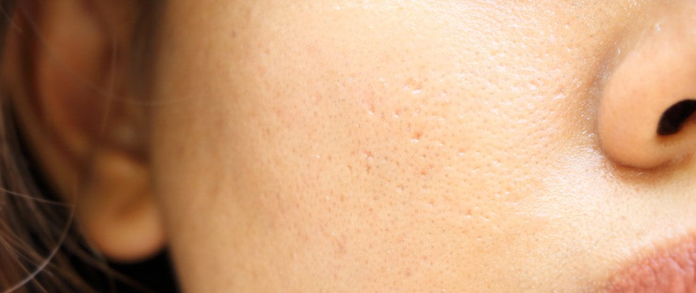 4 Surprising Everyday Factors that cause your Skin to Lose its Elasticity