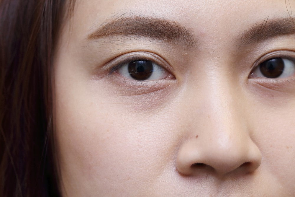 Free Radicals: What they are and How they Cause Panda Eyes